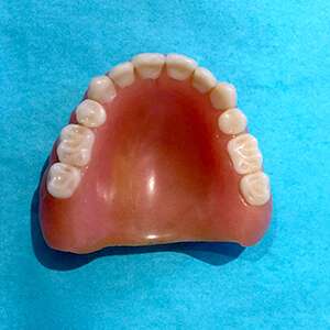 denture fracture fixed denture fracture fixed